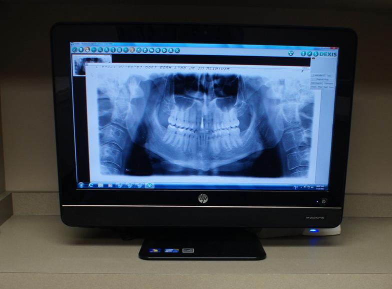 Bellevue Family Dentist - Dr. McIntosh - Latest Dental Technology